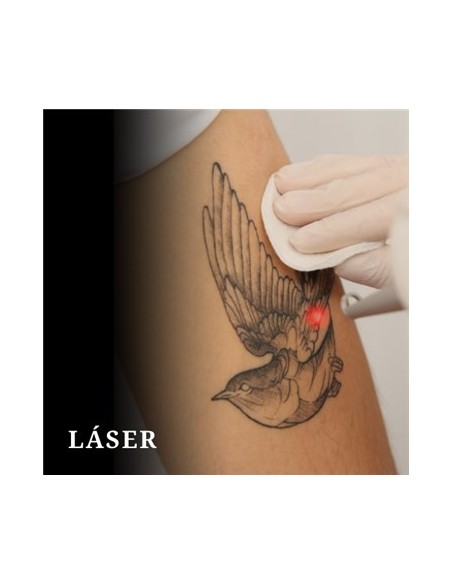 Taller de LASER - Micro y Tattoo