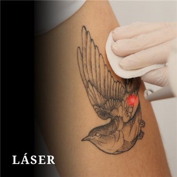 Taller de LASER - Micro y Tattoo